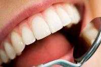 Carie dentali cure a Montecassiano